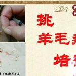 民间技法挑羊毛疔 刺血拔罐舌下取栓
